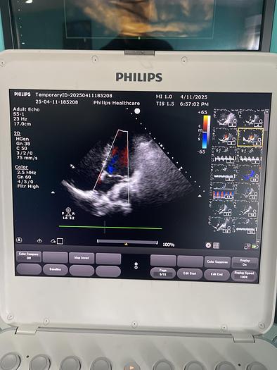 Gebraucht Philips CX50 Ultraschallgerät mit Sektor Sonde Model Version 5.0.2