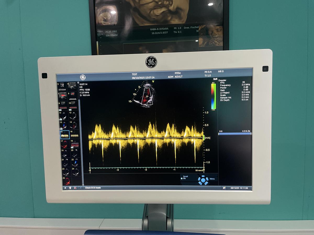 Gebraucht GE Vivid S70 Ultraschallgerät mit zwei Sonden