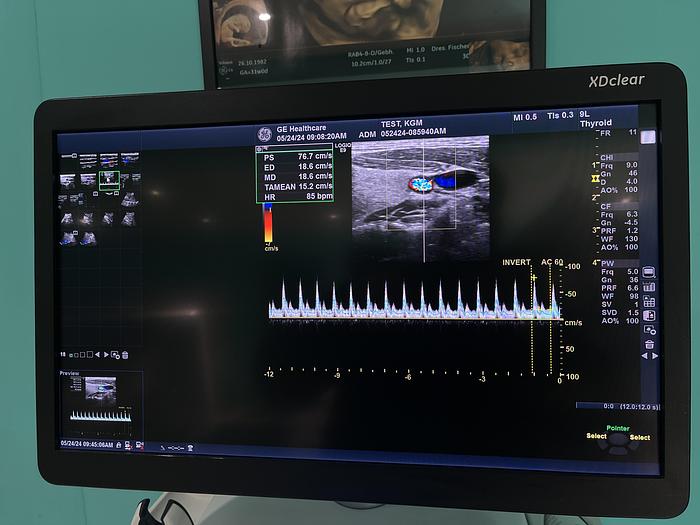 Gebraucht GE LOGIQ E9 XDClear 2.0 SW R6 Ultraschallgerät