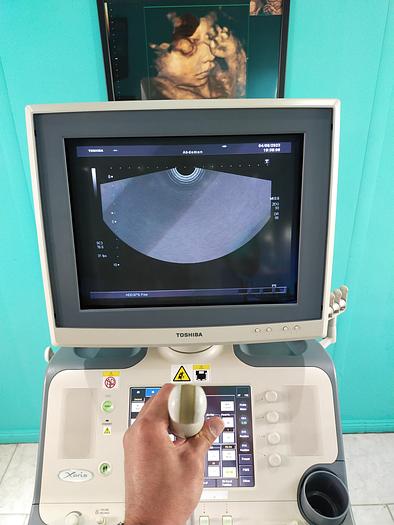 Gebraucht Toshiba Xario Ultraschallgerät