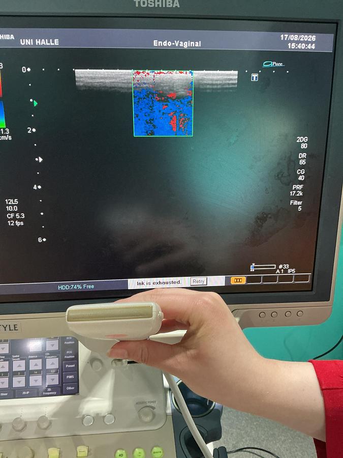 Gebraucht Toshiba PLT-805AT Linear Ultraschallsonde