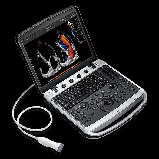 Chison SonoBook 9 tragbares Ultraschallgerät