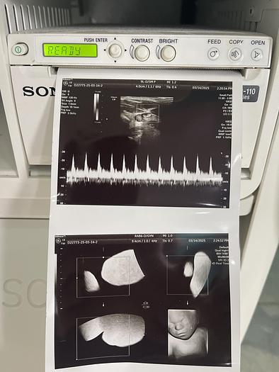 Gebraucht GE Voluson E8 BT13.5 Ultraschallgerät mit drei Sonden