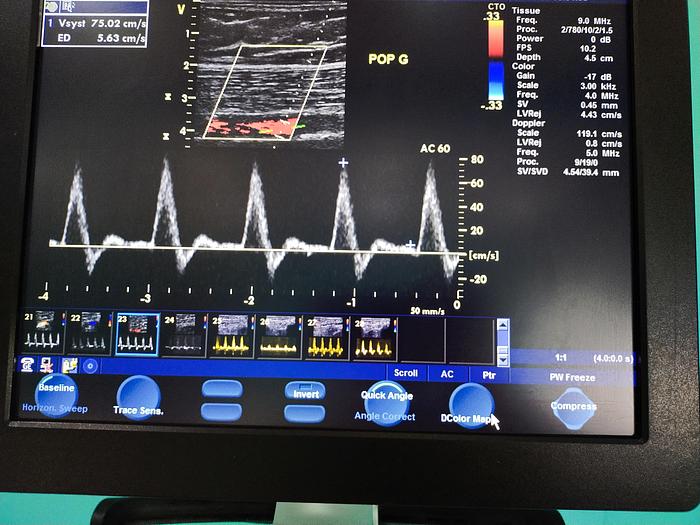 Gebraucht GE Vivid S5 Ultraschallgerät