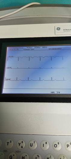 Gebraucht GE MAC 1200 ST EKG-Gerät