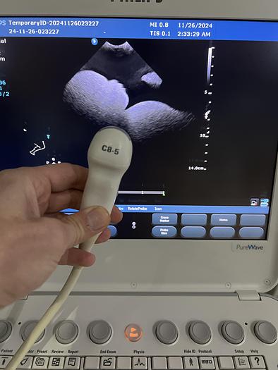 Used Philips C8-5 Mikro Konvex Ultraschallgerät