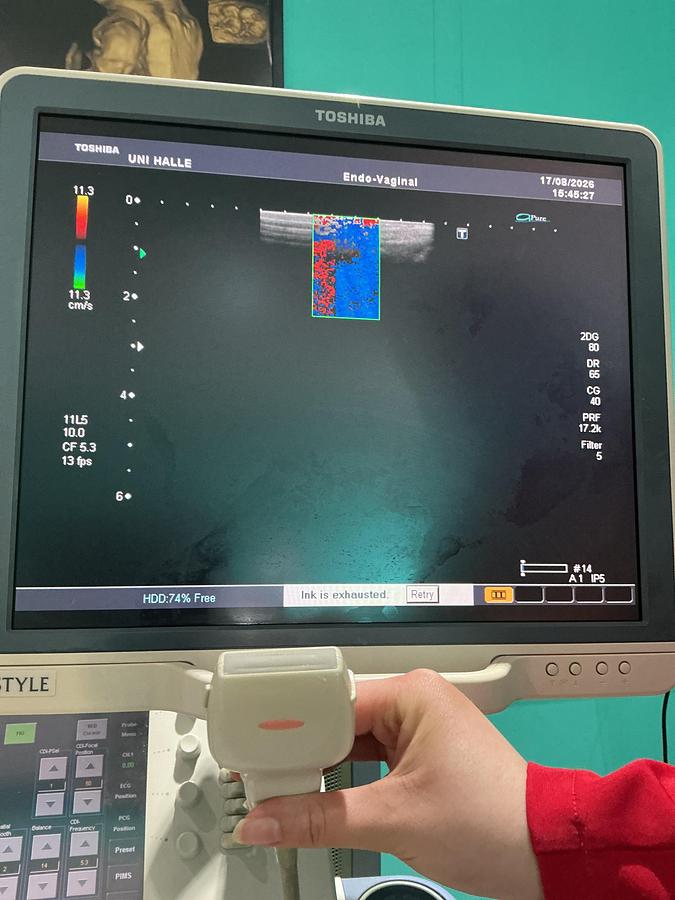 Gebraucht Toshiba PLT-704AT Linear Ultraschallsonde