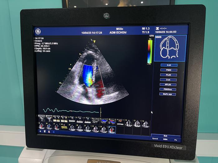 Gebraucht GE Vivid E9 XDclear Ultraschallgerät mit zwei Sonden und Drucker