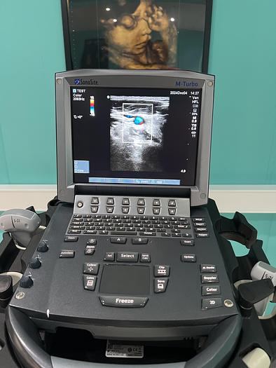 Gebraucht SonoSite  M-Turbo Ultraschallgerät mit drei Sonden