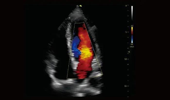 Vinno 5 tragbares Ultraschallgerät