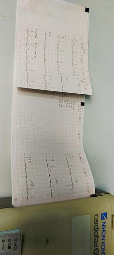 Gebraucht Nihon Kohden Cardiofax GEM EKG Gerät mit EKG Kabel