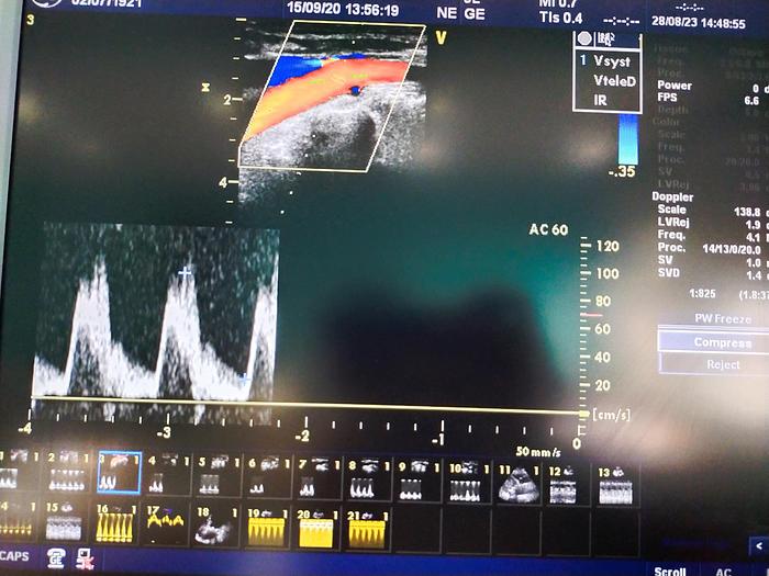 Gebraucht GE Vivid 7 Ultraschallgerät
