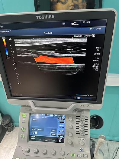 Used Toshiba Xario 200 Ultraschallgerät mit drei Sonden und Drucker 