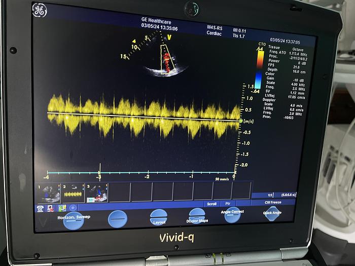 Gebraucht GE Vivid Q tragbares Ultraschallgerät auf Trolley mit kardio Sonde
