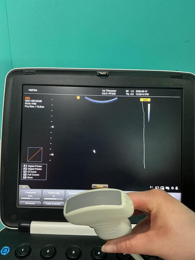 Gebraucht Samsung Medison HM7AF1B Ultraschallgerät mit zwei Sonden