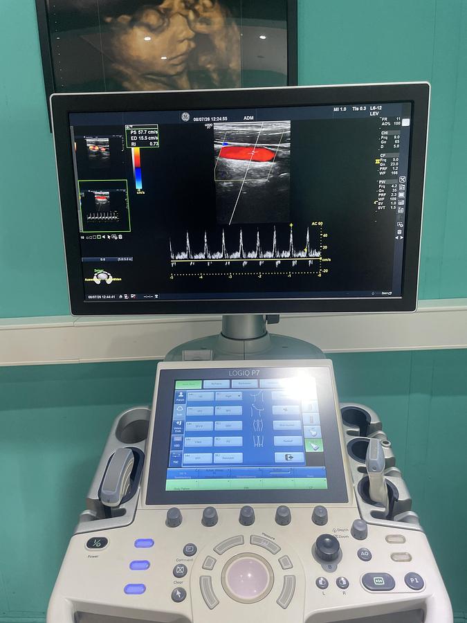 Gebraucht GE LOGIQ P7 Ultraschallgerät mit zwei Sonden