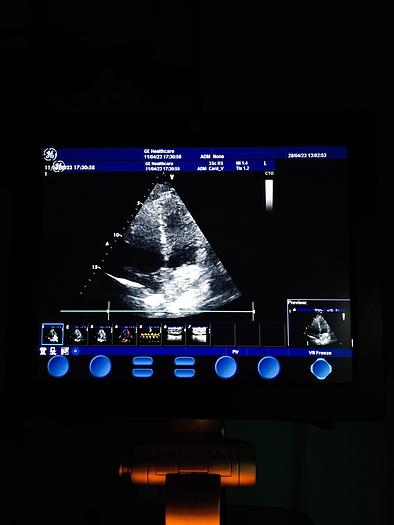 Gebraucht GE  Vivid S5  Ultraschallgerät auf Trolley mit 2 Sonden und EKG Kabel