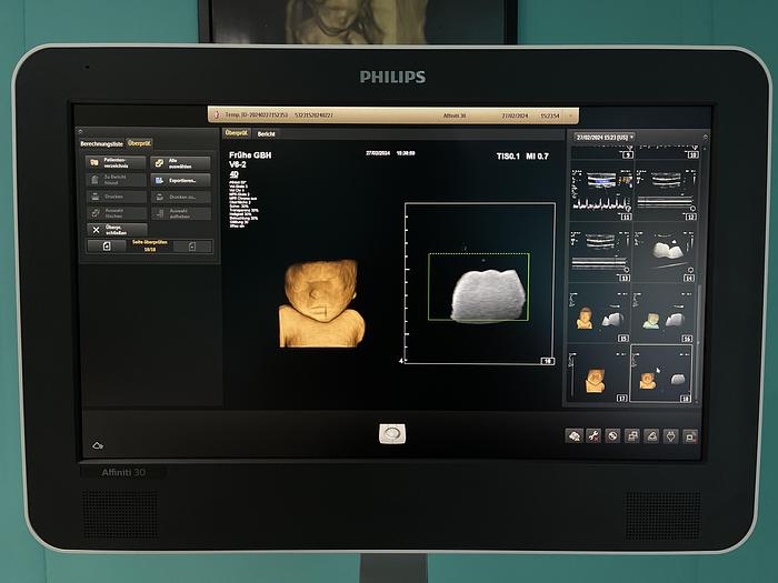 Used Philips Affiniti 30 Ultraschallgerät mit 3 Sonden und Drucker