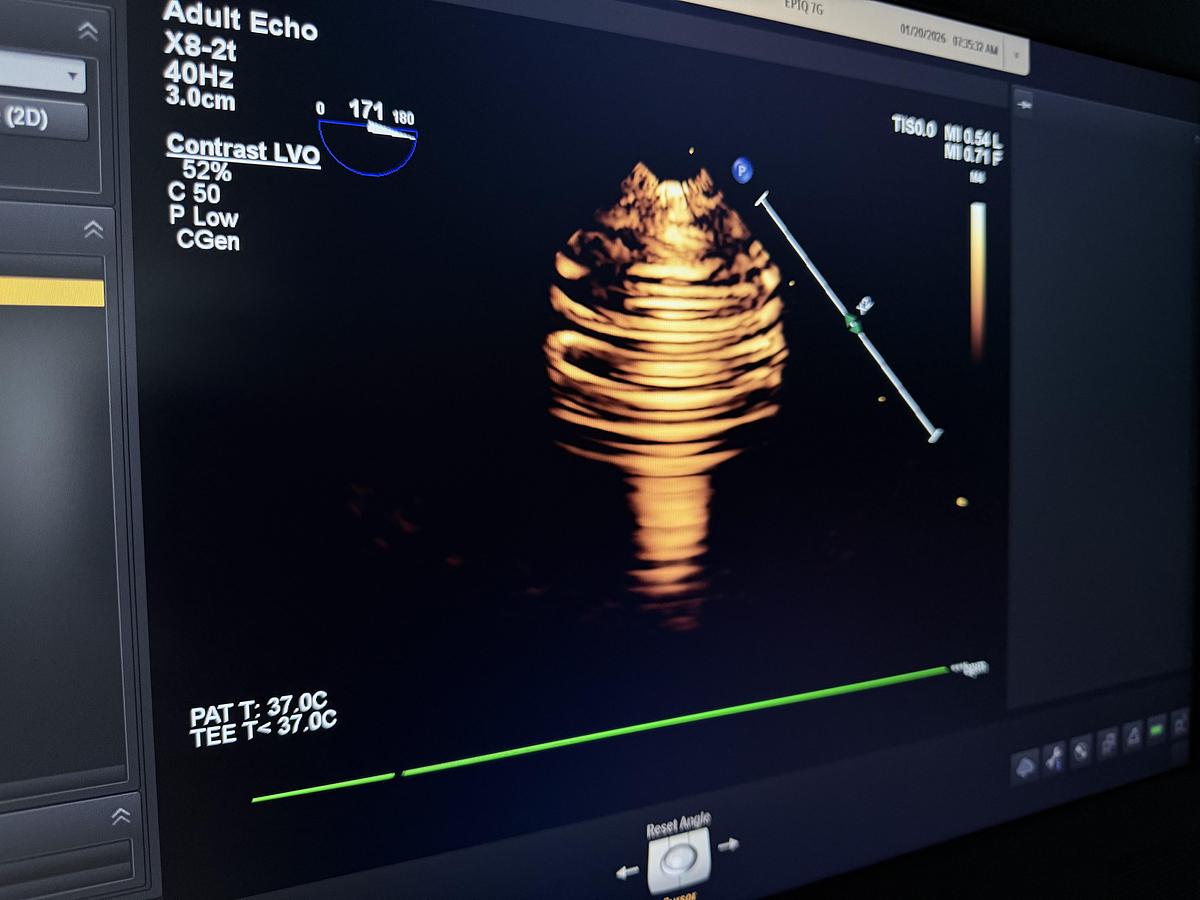 Gebraucht Philips X8-2T compact TEE Ultraschallsonde