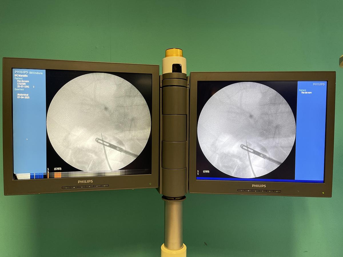 Gebraucht Philips BV-Endura C-Bogen Röntgengerät