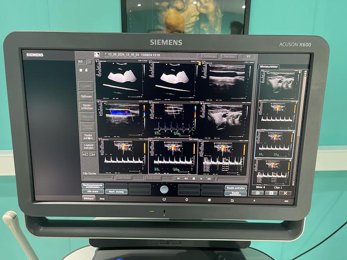 Used Siemens Acuson X600 Ultraschallgerät mit drei Sonden