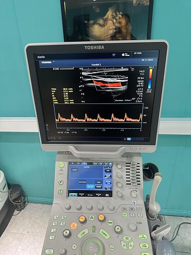 Used Toshiba Xario 200 Ultraschallgerät mit drei Sonden und Drucker 