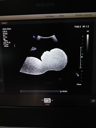 Gebraucht Philips C9-2 PureWave Convex Ultraschallsonde