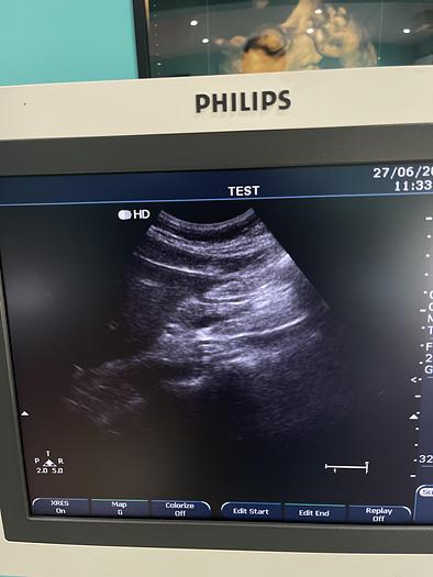 Used Philips HD7 XE Ultraschallgerät mit zwei Sonden und Drucker 