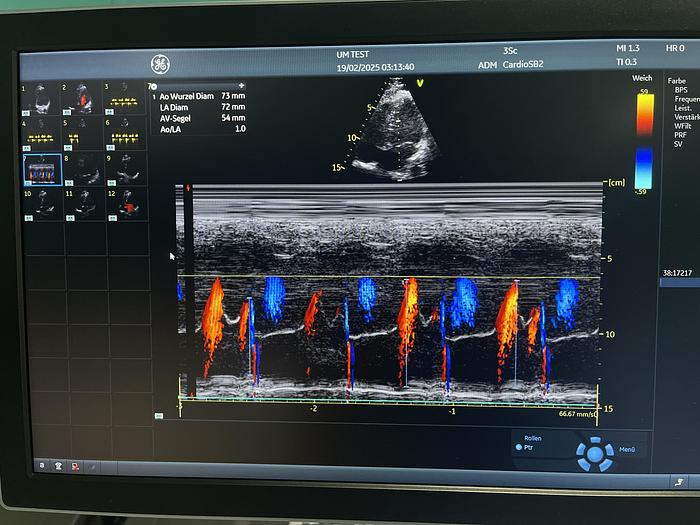 Gebraucht GE 3SC-RS Sektor Ultraschallsonde 