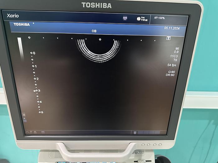 Used Toshiba Xario 200 Ultraschallgerät mit drei Sonden und Drucker 