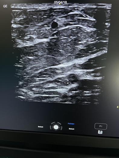 Gebraucht GE Versana Premier Ultraschallgerät mit drei Sonden