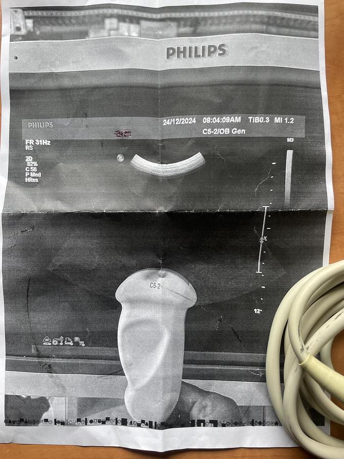 Gebraucht Philips C5-2 Konvex Ultraschallsonde