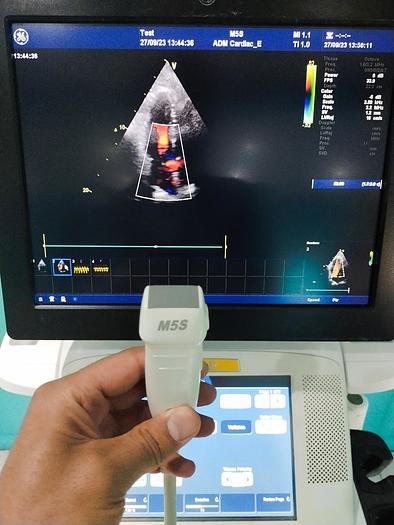 Gebraucht GE Vivid E9 Ultraschallgerät