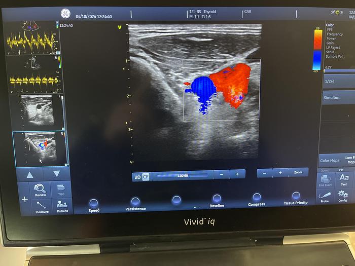 Used GE L12-RS Linear Ultraschallsonde