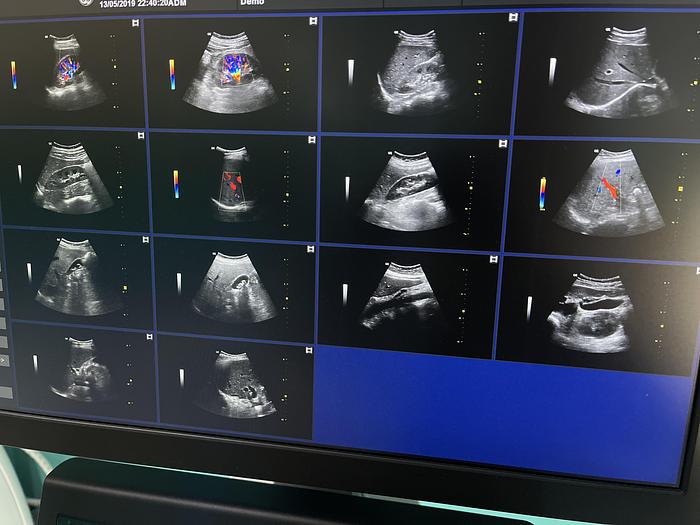 Gebraucht GE Versana Premier Ultraschallgerät mit drei Sonden