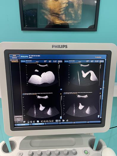 Used Philips HD9 Ultraschallgerät mit drei Sonden