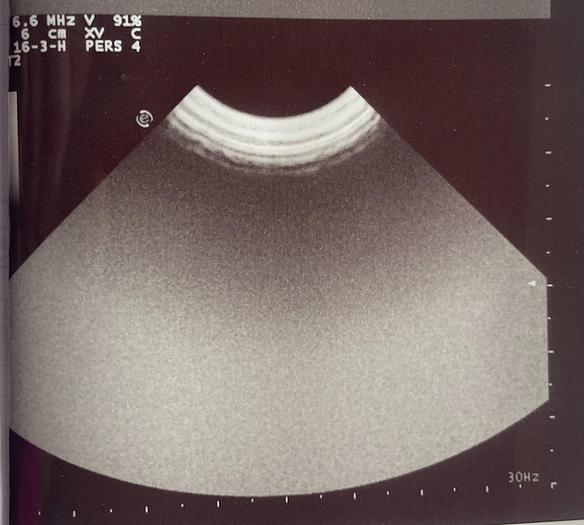 Used Esaote CA123 Mikro Konvex Ultraschallsonde