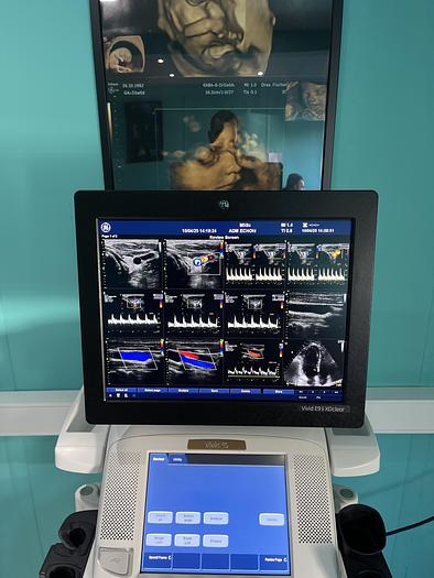 Gebraucht GE Vivid E9 XDclear Ultraschallgerät mit zwei Sonden und Drucker