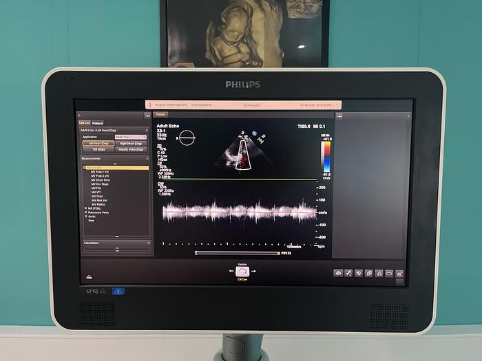 Used Philips EPIQ 5G Ultraschallgerät mit zwei Sonden