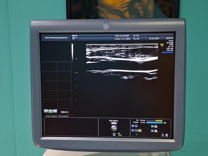 Gebraucht GE ML6-15-D Ultraschallsonde 