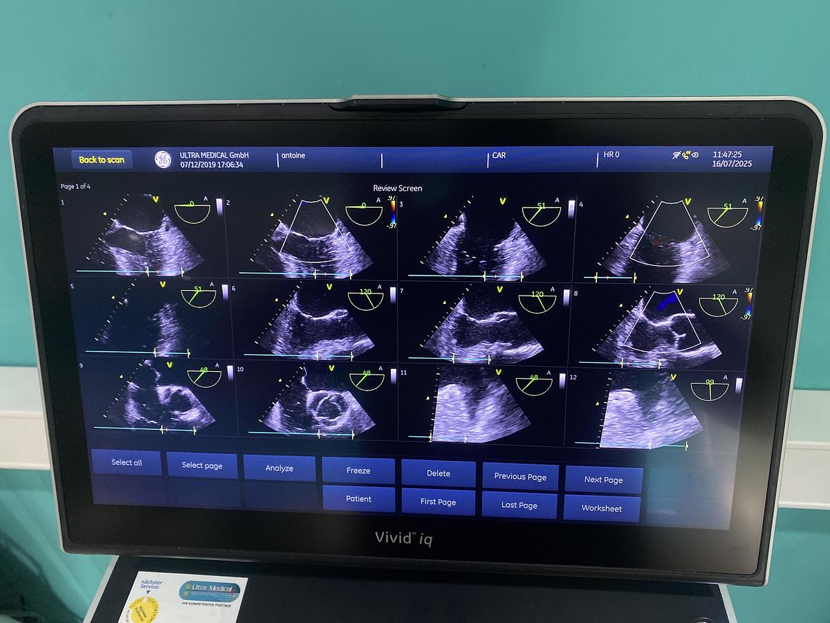 Gebraucht GE Vivid iq Ultraschallgerät mit M5Sc-RS Kardiosonde