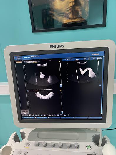 Used Philips HD9 Ultraschallgerät mit drei Sonden