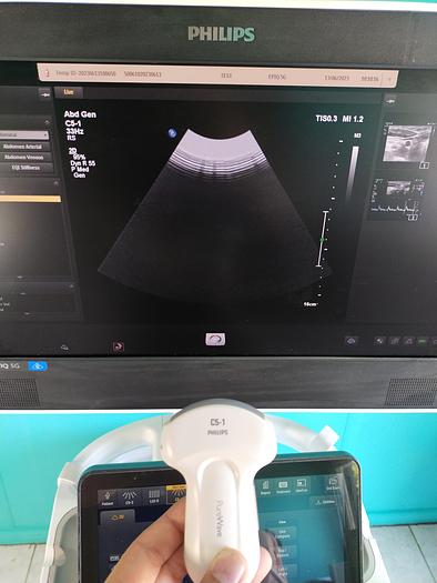 Gebraucht Philips Epiq 5G Flat Screen Ultrasound Scanner