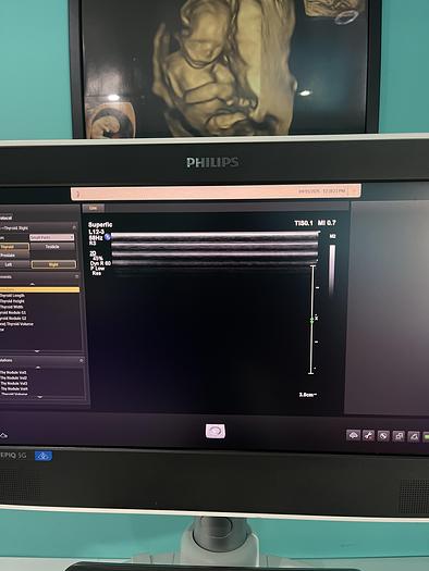 Gebraucht Philips EPIQ 5G Ultraschallgerät 