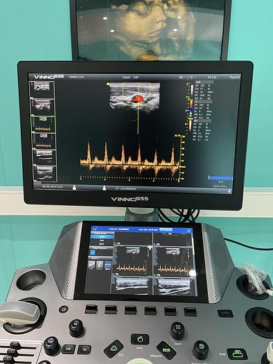 Used Vinno G55 Ultraschallgerät mit Konvex Sonde