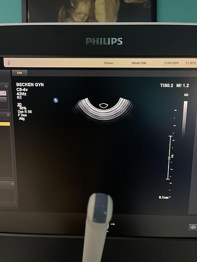 Gebraucht Philips Affiniti 50W Ultraschallgerät mit 3 Sonden und Drucker SV 9.0.5