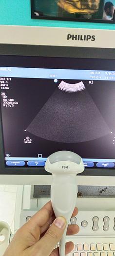 Gebraucht Philips V8-4 3D/4D Volumen Ultraschallsonde