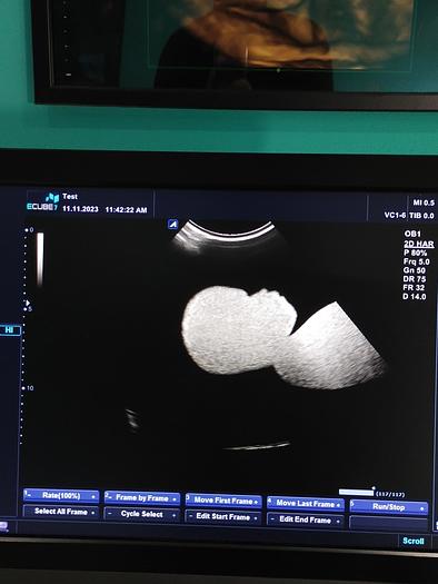 Gebraucht Alpinion Ecube 7  Ultraschallgerät