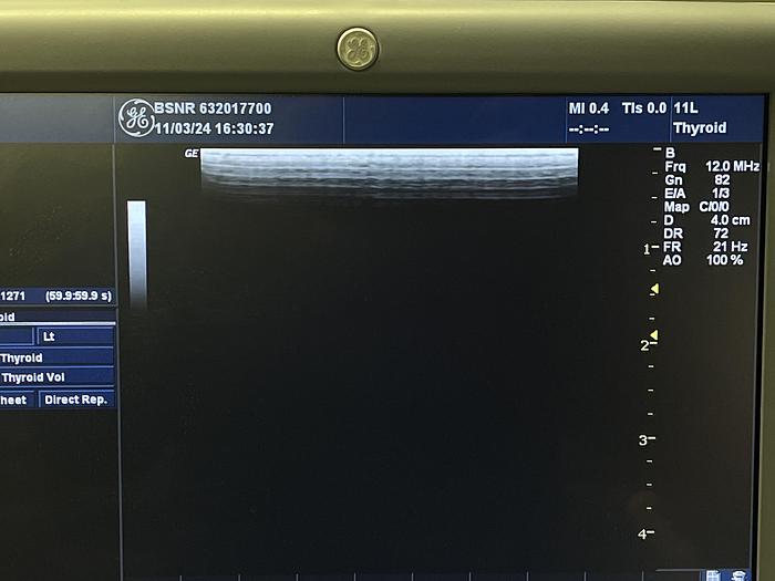 Gebraucht GE 11L linear Ultraschallsonde