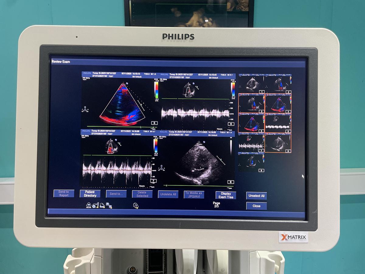 Gebraucht Philips iE33 HW G.1  xMatrix Ultraschallgerät mit S5-1 Kardiosonde und Drucker